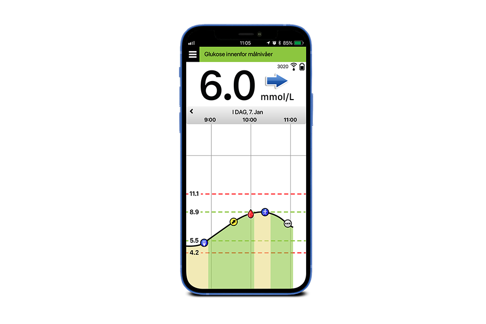 Telefonskjerm viser cgm-teknologi på Eversense-systemapp.