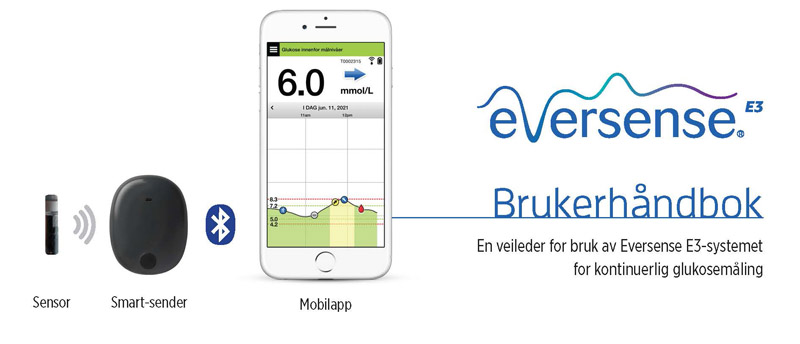 eversense_diagram.jpg