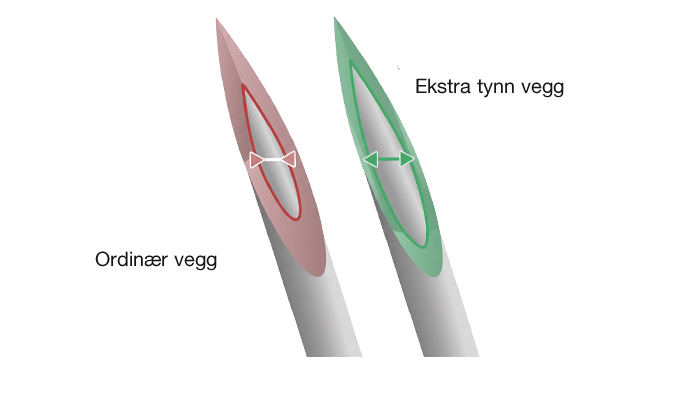 Ordinær vegg